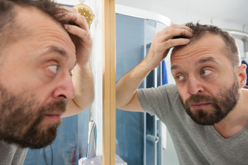 Worried man looking at his decreasing hairline