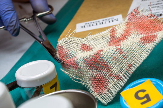 Police specialist examines piece of cloth stained with blood belonging to the victim of murder, conceptual image