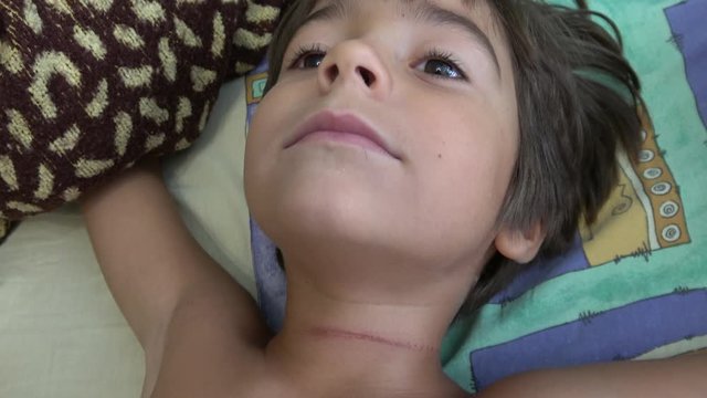 4K Madcap child with a sore mark on his neck yawns