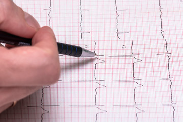 ECG paper graph report, electrocardiogram on paper form as background