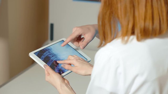 Doctors watch x-ray picture on the tablet and discuss
