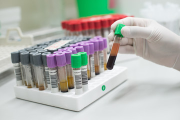 laboratory technician blood group test,malaria test