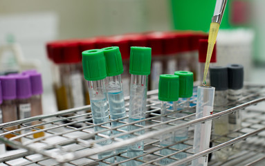 Lab technician blood group test,malaria test