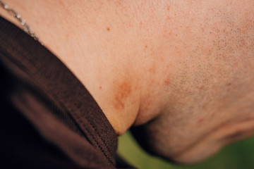 Hickey on the neck of a young man. Traces of kiss on the neck guy. Hickey and stubble on a man's body