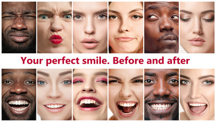 Beautiful close up male and female portraits. Concept of beauty, correction, treatment and teeth whitening. Braces, veneers, implantation, dentistry. Before and after. Colorful flyer for your