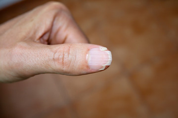 Splitting nail on the thumb of an adult male on brown background.