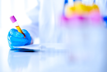 Scientist in a laboratory holds a test tube. Researcher is surrounded by medical vials and flasks