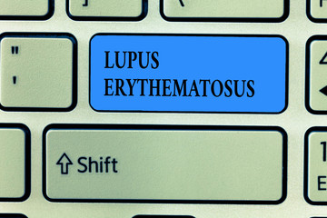 Handwriting text writing Lupus Erythematosus. Concept meaning inflammatory condition caused by an...