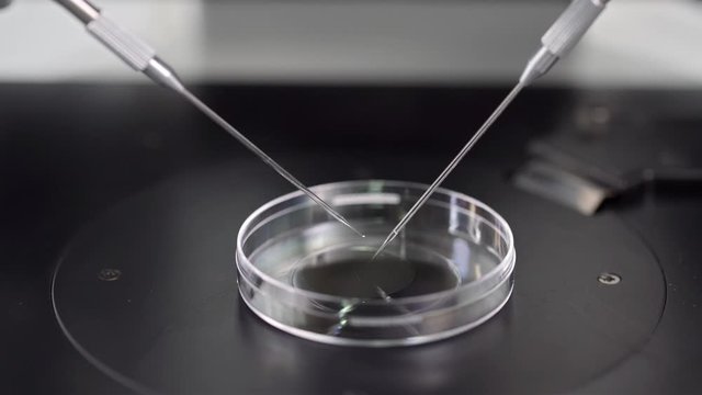 Process of in vitro fertilization in laboratory