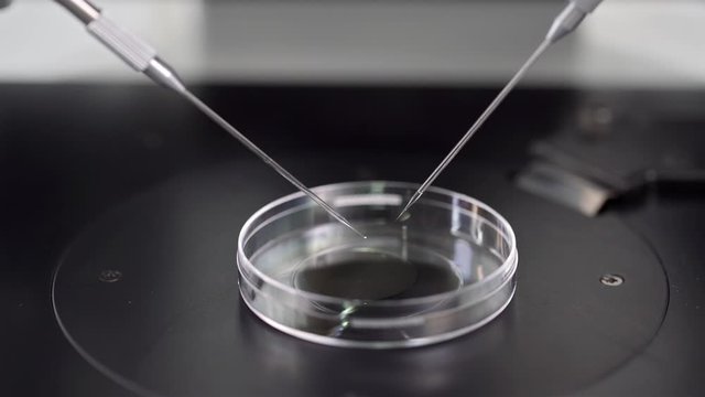 Process of in vitro fertilization in laboratory