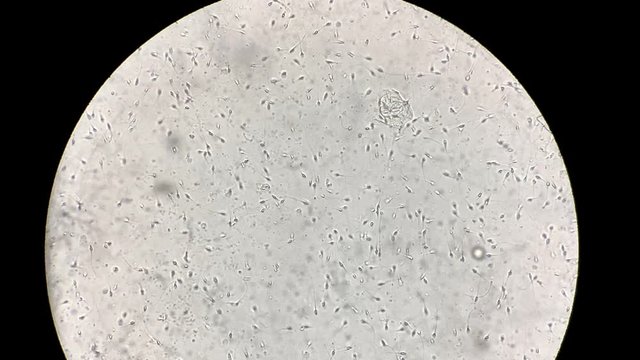 View at human sperm under microscope in lab