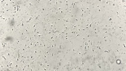 View at human sperm under microscope in lab