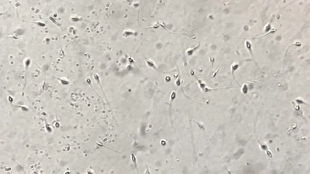 View at human sperm under microscope in lab
