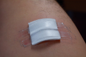 Wound with bandage on the leg