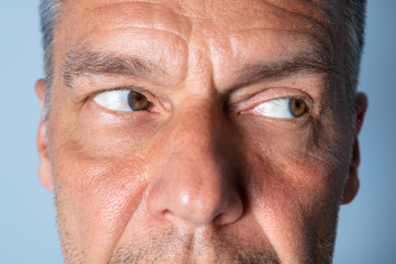 Man Doing Shifting Eye Exercise