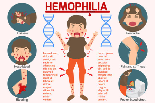 Hemophilia symptom Infographics elements. Sign and Symbols of Hemophilia. Health and Medical concept. Vector cartoon illustration isolated.