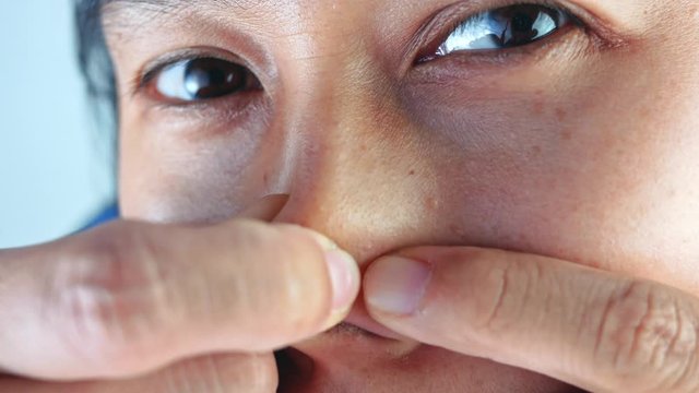 Close-up of young woman Asian squeezing pimple on nose.