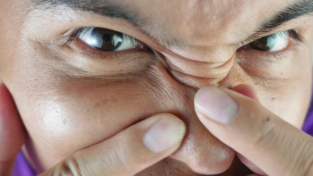 Close-up of young woman Asian squeezing pimple on nose.