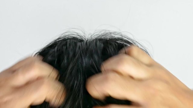 Close-up of woman hand itchy scalp caused by dandruff or skin disease. Hair care concept.