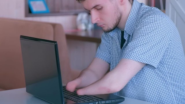 Portrait of disabled man with amputated two stump hands typing working on laptop in cafe, side view. Freelancer computer online job. Independent handicapped young guy invalid. Problem adaptation.