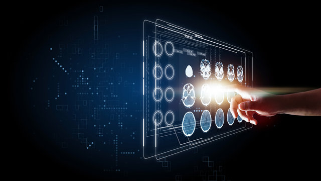 medical technology CT brain and x-ray image, hand touching futuristic technology, visual system touching to start working and connection, info graphic concept 