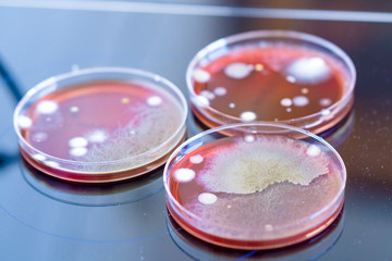 petri dishes with colonies of microorganisms in a biological laboratory