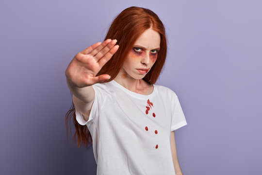 angry confident woman with many bruses on her face trying to stop violence. say no to abuse