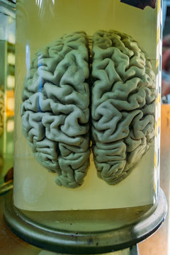 Human brain in glass jar with formaldehyde for medical studies