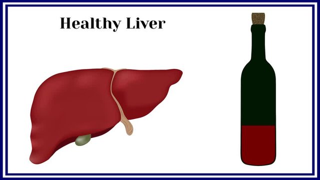 Cirrhosis. Violation of liver structure.