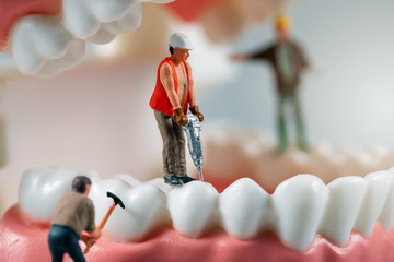dental treatment concept - miniature figurines of construction workers on teeth model