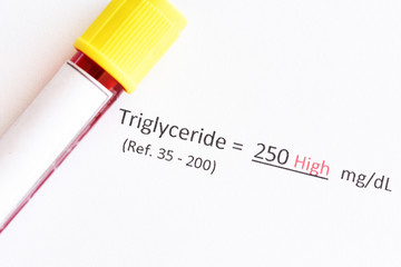 Blood sample with abnormal high triglyceride test result