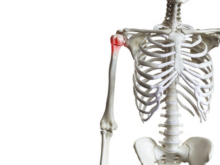 3d rendered medically accurate illustration of a broken humerus