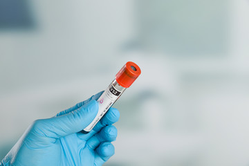 Doctor's hand with medical glove holding a blood probe. in front of a lab