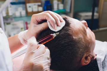 Treatment of baldness with beauty injections. Cosmetologist hands in gloves make a subcutaneous...