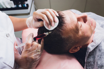Treatment of baldness with beauty injections. Cosmetologist hands in gloves make a subcutaneous injection. Plasmalifting male patient.
