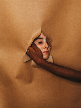 Vitiligo skin girl