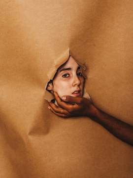 Vitiligo skin girl