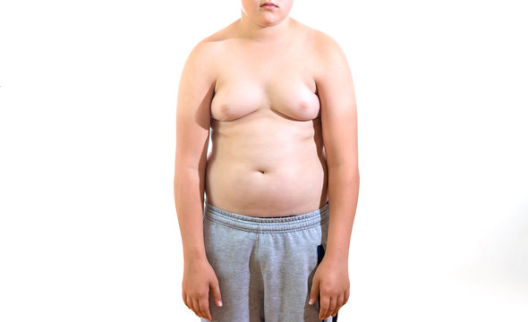 child fat body with folds on isolated white background