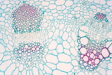 Cross sections of plants stem show plant vascular tissue under microscope view.
