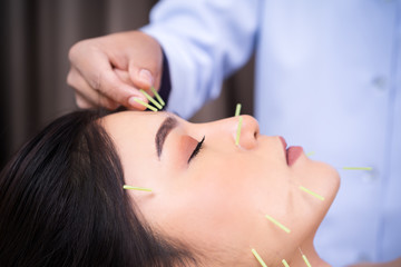 woman undergoing acupuncture treatment on face - obrazy, fototapety, plakaty