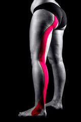Medical taping for sciatic neuralgia showed on young model.