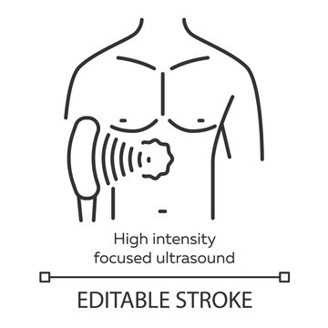 High intensity focused ultrasound linear icon. HIFU. Non-invasive therapeutic technique. Thin line illustration. Contour symbol. Vector isolated outline drawing. Editable stroke