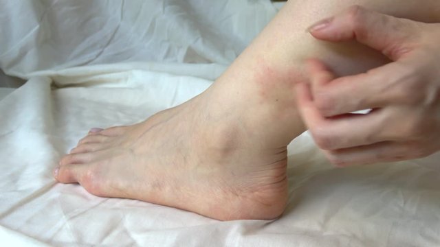 足首を掻く女性  4K  Young woman scratching her ankle