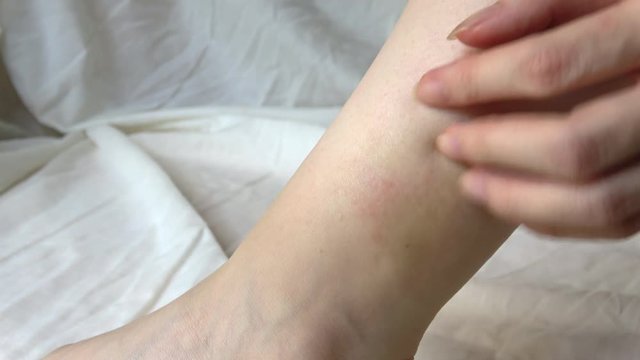 足首を掻く女性  4K  Young woman scratching her ankle
