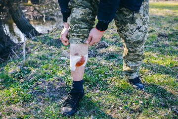 Man is putting bandage on bleeding wound. Injured leg. Tourist in the nature. Infection danger....