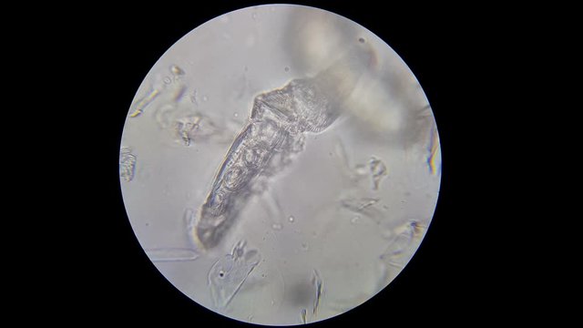 Demodex on dog's skin video taken with microscope under big magnification