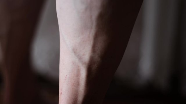 Varicose veins on a leg in Senior woman, closeup