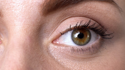 Closeup of female eye, suffering dry eye syndrome, vision problems fatigue