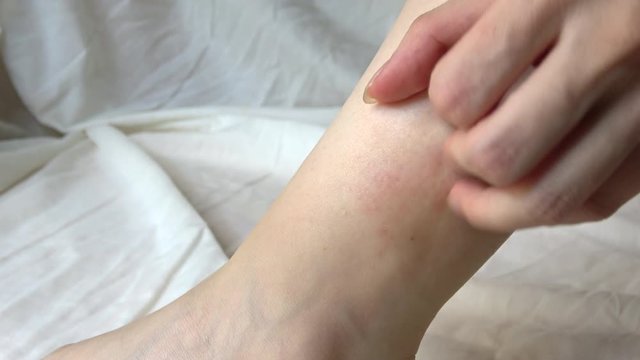足首を掻く女性  4K  Closeup shot of a young woman scratching her ankle