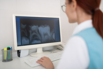 Fototapeta na wymiar Close up of dentist sitting near computer and studying X-ray